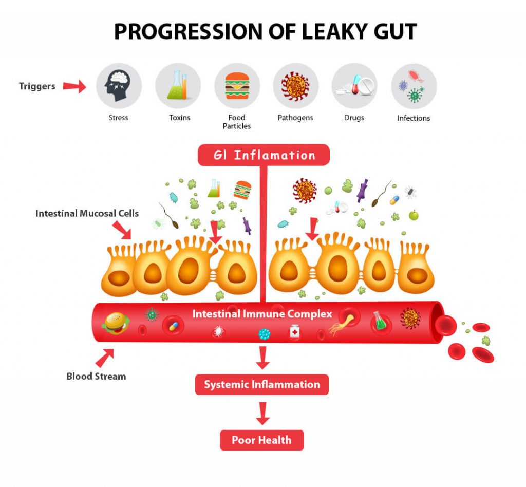 progression of leaky gut