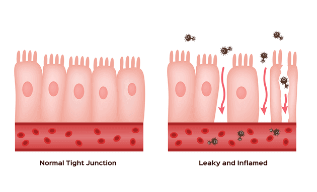 Leaky gut