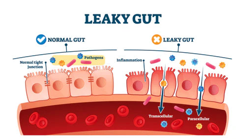 leaky gut